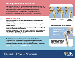 Photo ofHip Replacement Procedure 
