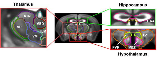 illustration of Manganese-Enhancement MRI