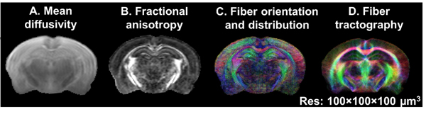 illustration of dMRI