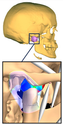 Temporomandibular Joint Model