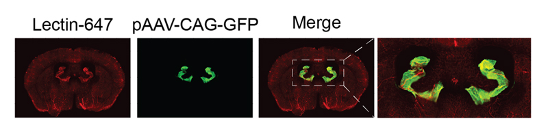 The changes of brain fluid homeostasis in hydrocephalus